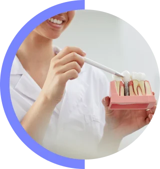 doctor sosteniendo implantes dentales